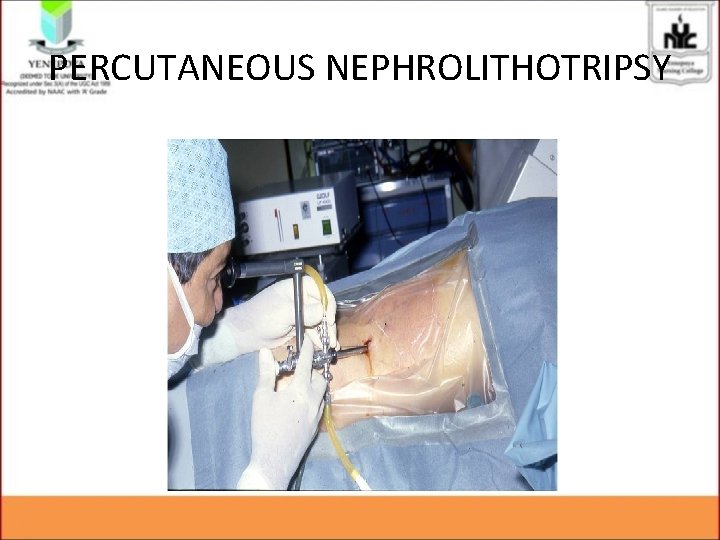 PERCUTANEOUS NEPHROLITHOTRIPSY PERCUTANEOUS NEPHROLITHOTRIPSY