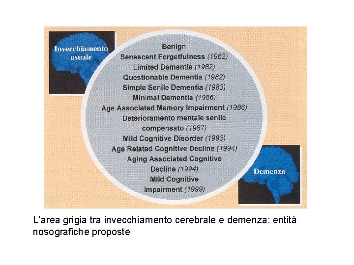 L’area grigia tra invecchiamento cerebrale e demenza: entità nosografiche proposte 
