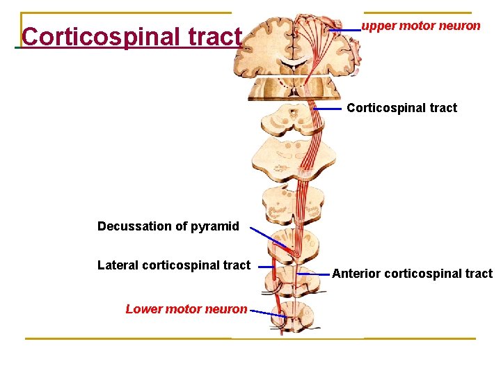 Corticospinal tract upper motor neuron Corticospinal tract Decussation of pyramid Lateral corticospinal tract Lower Corticospinal tract upper motor neuron Corticospinal tract Decussation of pyramid Lateral corticospinal tract Lower