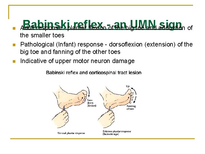 n n n Babinski reflex - an UMN sign Adult response - plantar flexion n n n Babinski reflex - an UMN sign Adult response - plantar flexion