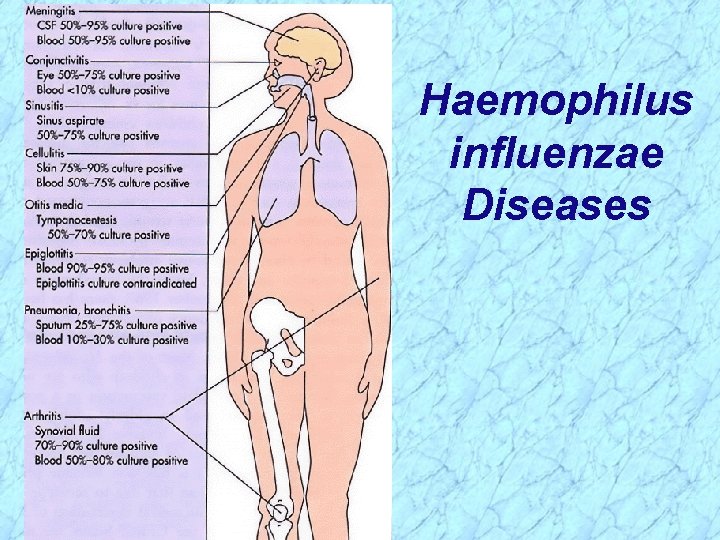 Haemophilus influenzae Diseases 