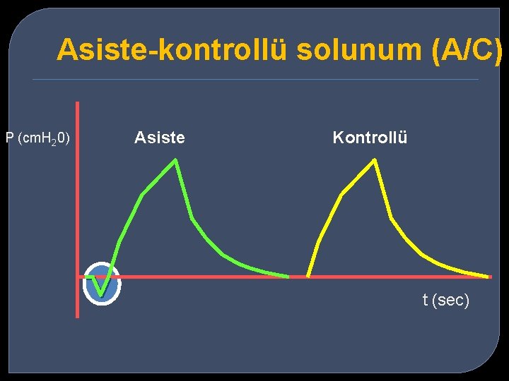 Asiste-kontrollü solunum (A/C) P (cm. H 20) Asiste Kontrollü t (sec) 