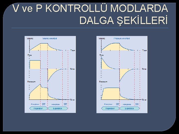 V ve P KONTROLLÜ MODLARDA DALGA ŞEKİLLERİ 