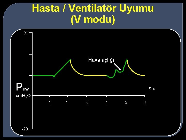 Hasta / Ventilatör Uyumu (V modu) 30 Hava açlığı Paw Sec cm. H 2