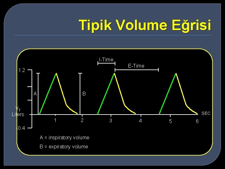 Tipik Volume Eğrisi I-Time E-Time 1. 2 A B VT Liters SEC 1 2