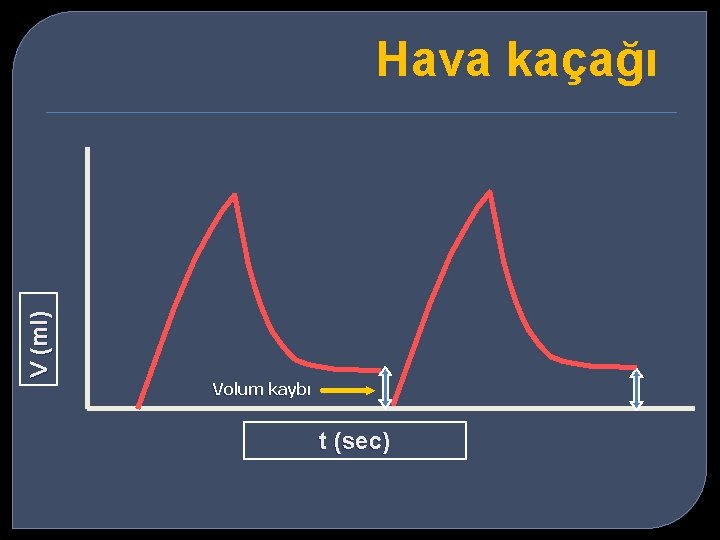 V (ml) Hava kaçağı Volum kaybı t (sec) 