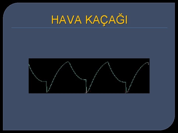 HAVA KAÇAĞI 