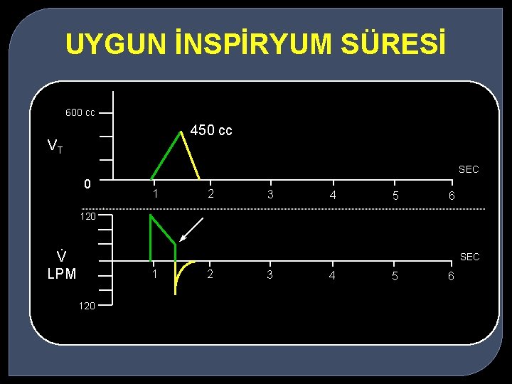 UYGUN İNSPİRYUM SÜRESİ 600 cc 450 cc VT SEC 0 1 2 3 4