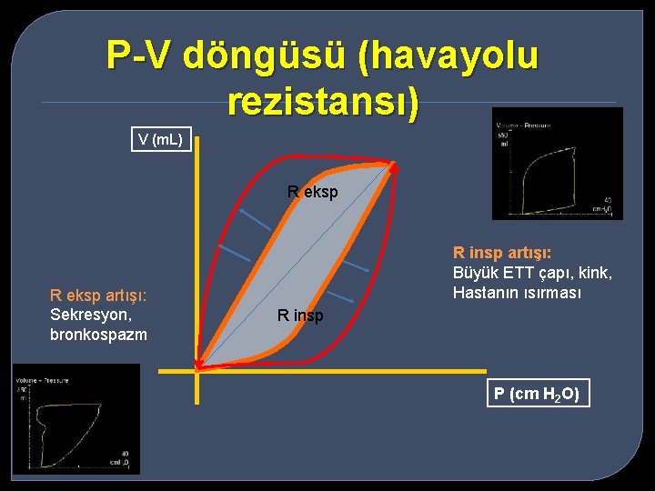 P-V döngüsü (havayolu rezistansı) V (m. L) R eksp artışı: Sekresyon, bronkospazm R insp