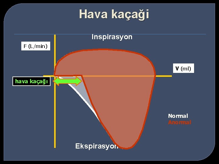 Hava kaçaği Inspirasyon F (L/min) V (ml) hava kaçağı Normal Anormal Ekspirasyon 