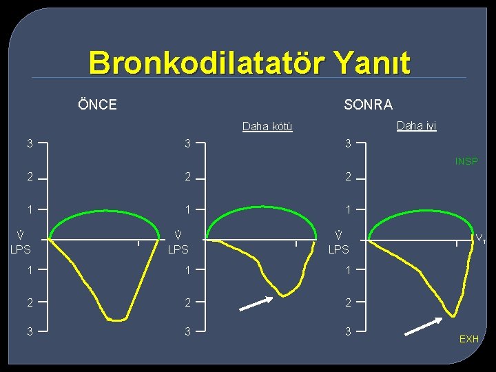 Bronkodilatatör Yanıt ÖNCE SONRA Daha iyi Daha kötü 3 3 3 INSP . V