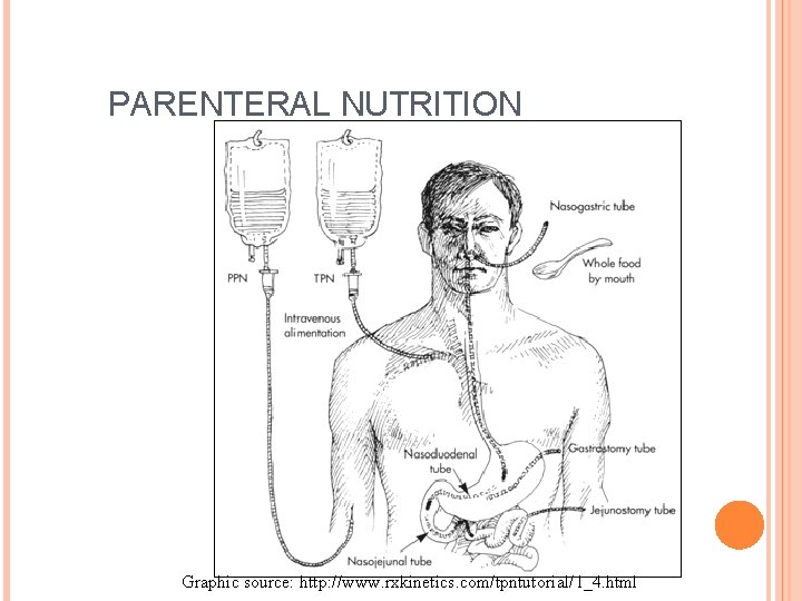 PARENTERAL NUTRITION Graphic source: http: //www. rxkinetics. com/tpntutorial/1_4. html 