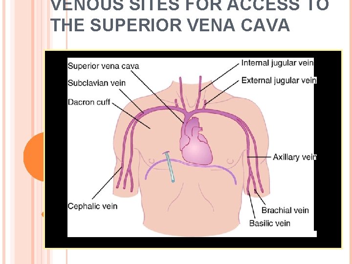 VENOUS SITES FOR ACCESS TO THE SUPERIOR VENA CAVA 
