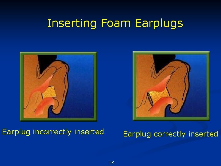 Inserting Foam Earplugs Earplug incorrectly inserted Earplug correctly inserted 19 