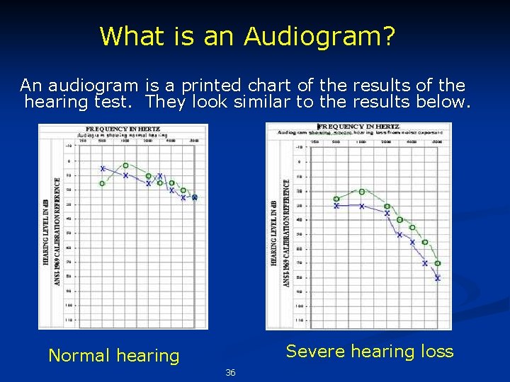 What is an Audiogram? An audiogram is a printed chart of the results of