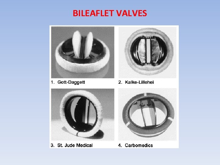 BILEAFLET VALVES 