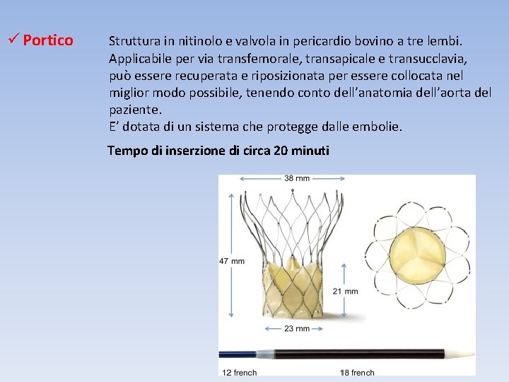 ü Portico Struttura in nitinolo e valvola in pericardio bovino a tre lembi. Applicabile