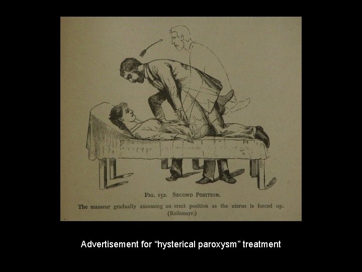 Advertisement for “hysterical paroxysm” treatment 