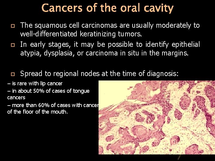 Cancers of the oral cavity The squamous cell carcinomas are usually moderately to well-differentiated