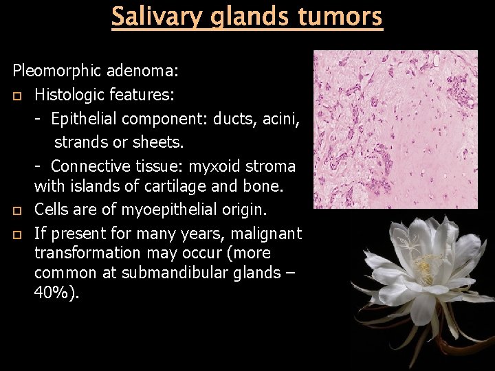 Salivary glands tumors Pleomorphic adenoma: Histologic features: - Epithelial component: ducts, acini, strands or