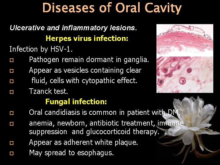 Diseases of Oral Cavity Ulcerative and inflammatory lesions. Herpes virus infection: Infection by HSV-1.