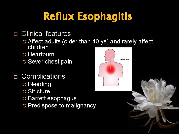 Reflux Esophagitis Clinical features: Affect adults (older than 40 ys) and rarely affect children