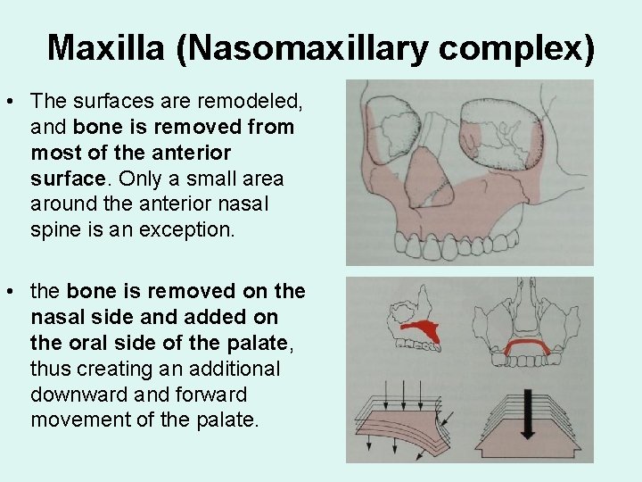 Maxilla (Nasomaxillary complex) • The surfaces are remodeled, and bone is removed from most