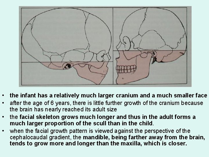  • the infant has a relatively much larger cranium and a much smaller
