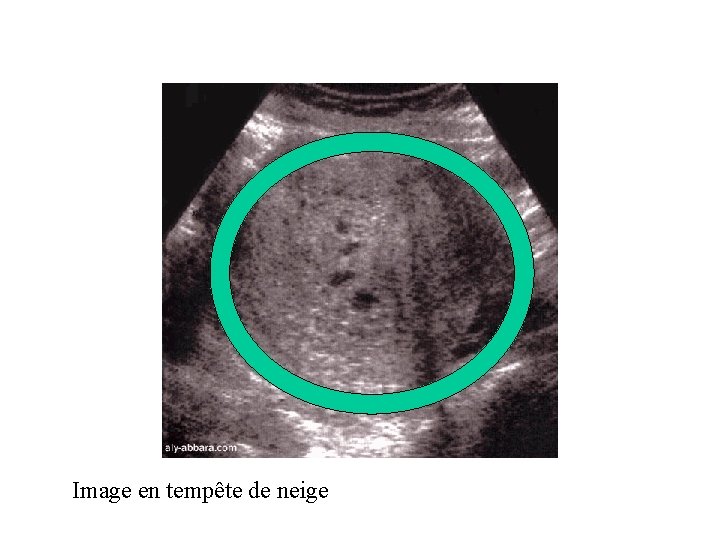 Image en tempête de neige 