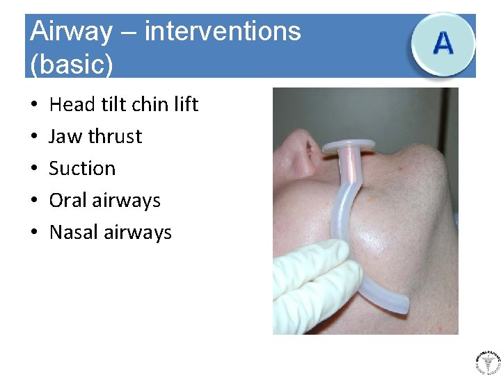 Airway – interventions (basic) • • • Head tilt chin lift Jaw thrust Suction