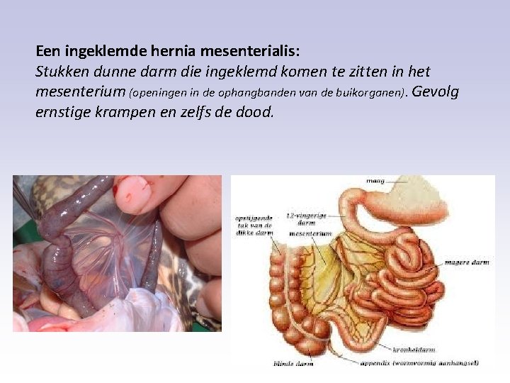 Een ingeklemde hernia mesenterialis: Stukken dunne darm die ingeklemd komen te zitten in het