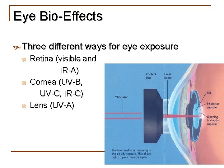 Eye Bio-Effects Three different ways for eye exposure Retina (visible and IR-A) z Cornea