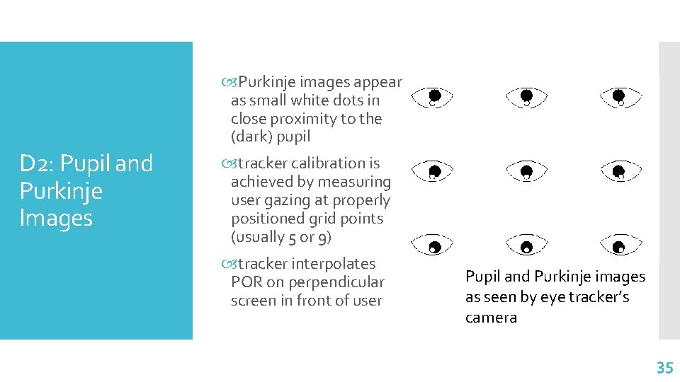Purkinje images appear as small white dots in close proximity to the (dark) Purkinje images appear as small white dots in close proximity to the (dark)