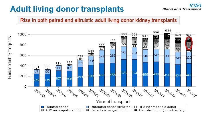 Adult living donor transplants Rise in both paired and altruistic adult living donor kidney