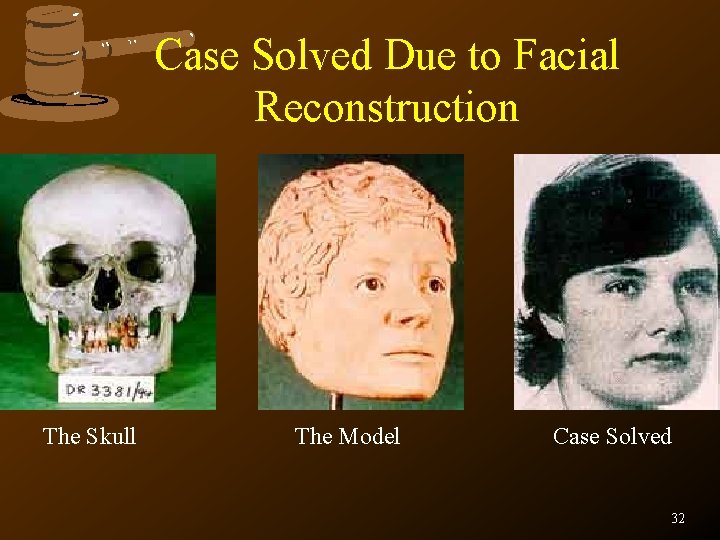 Case Solved Due to Facial Reconstruction The Skull The Model Case Solved 32 