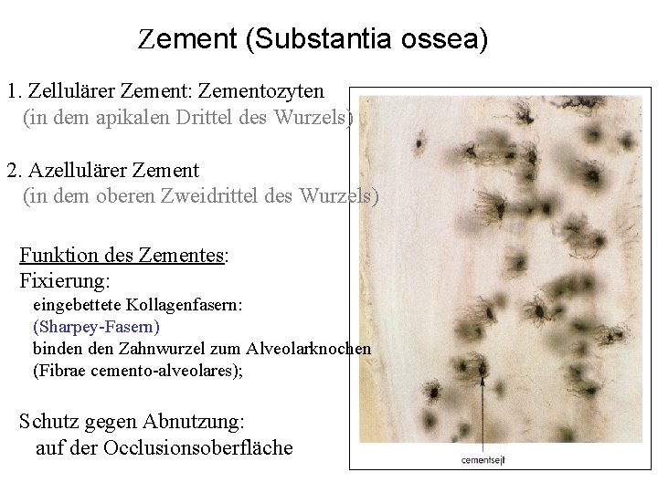 Zement (Substantia ossea) 1. Zellulärer Zement: Zementozyten (in dem apikalen Drittel des Wurzels) 2.