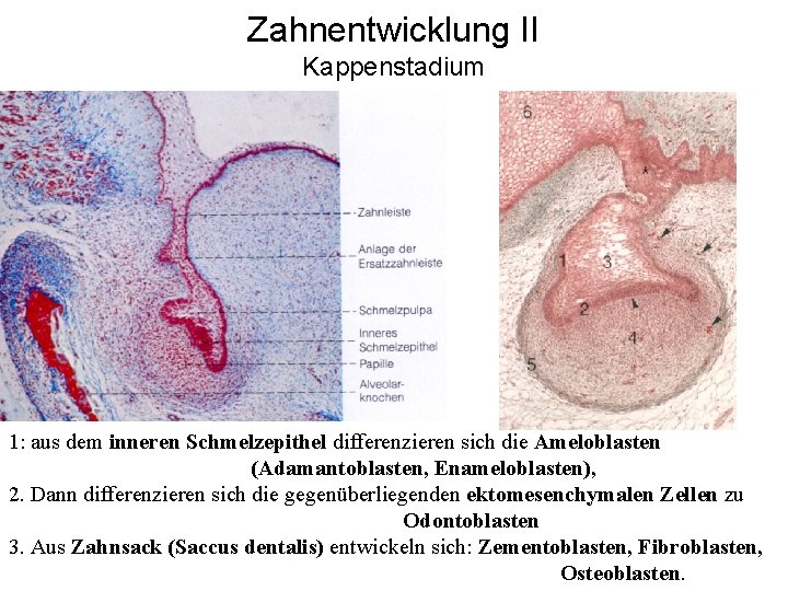 Zahnentwicklung II Kappenstadium 1: aus dem inneren Schmelzepithel differenzieren sich die Ameloblasten (Adamantoblasten, Enameloblasten),