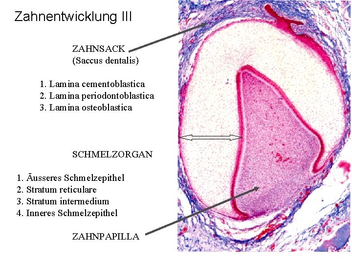 Zahnentwicklung III ZAHNSACK (Saccus dentalis) 1. Lamina cementoblastica 2. Lamina periodontoblastica 3. Lamina osteoblastica