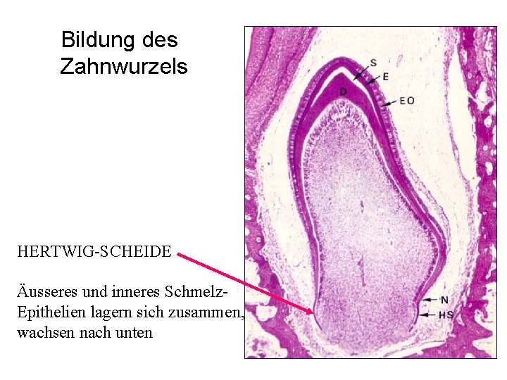 Bildung des Zahnwurzels HERTWIG-SCHEIDE Äusseres und inneres Schmelz. Epithelien lagern sich zusammen, wachsen nach Bildung des Zahnwurzels HERTWIG-SCHEIDE Äusseres und inneres Schmelz. Epithelien lagern sich zusammen, wachsen nach