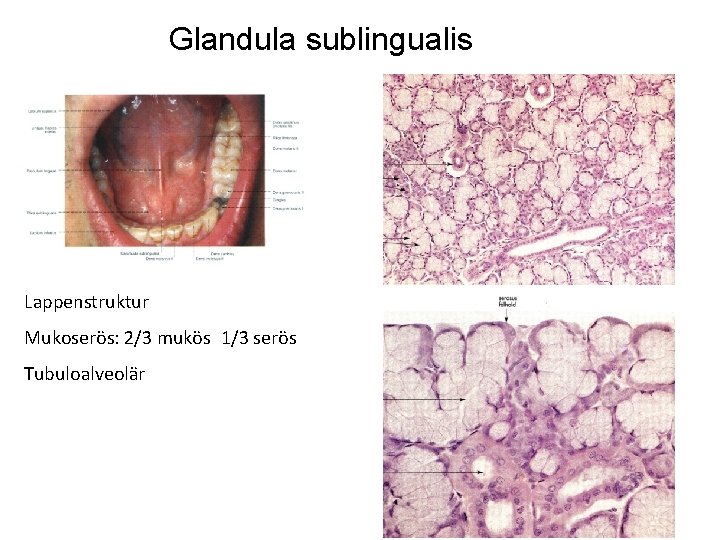 Glandula sublingualis Lappenstruktur Mukoserös: 2/3 mukös 1/3 serös Tubuloalveolär Glandula sublingualis Lappenstruktur Mukoserös: 2/3 mukös 1/3 serös Tubuloalveolär