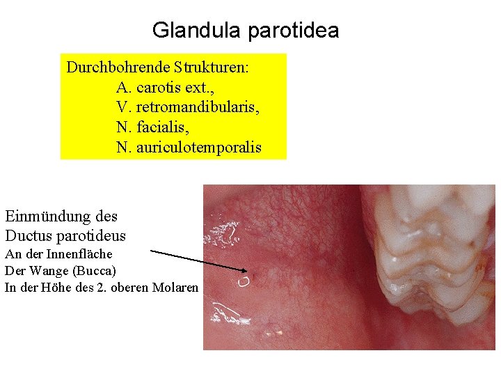 Glandula parotidea Durchbohrende Strukturen: A. carotis ext. , V. retromandibularis, N. facialis, N. auriculotemporalis