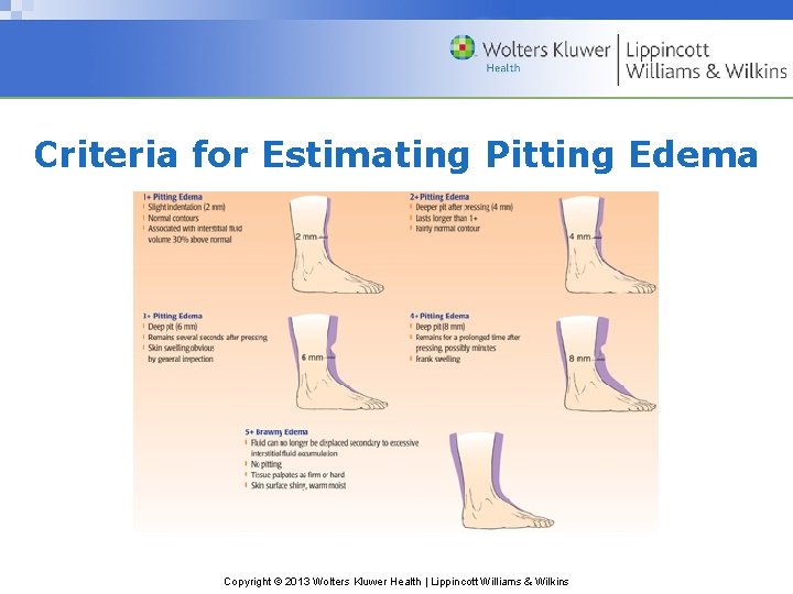 Criteria for Estimating Pitting Edema Copyright © 2013 Wolters Kluwer Health | Lippincott Williams