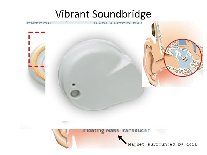 Vibrant Soundbridge Magnet surrounded by coil Vibrant Soundbridge Magnet surrounded by coil