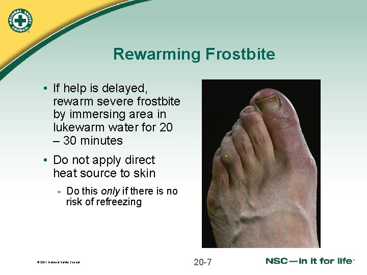 Rewarming Frostbite • If help is delayed, rewarm severe frostbite by immersing area in
