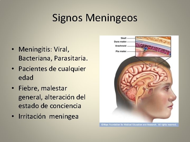 Signos Meningeos • Meningitis: Viral, Bacteriana, Parasitaria. • Pacientes de cualquier edad • Fiebre,