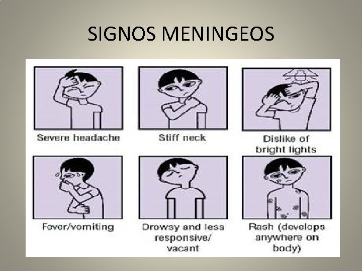 SIGNOS MENINGEOS 