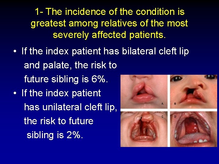 1 - The incidence of the condition is greatest among relatives of the most 1 - The incidence of the condition is greatest among relatives of the most