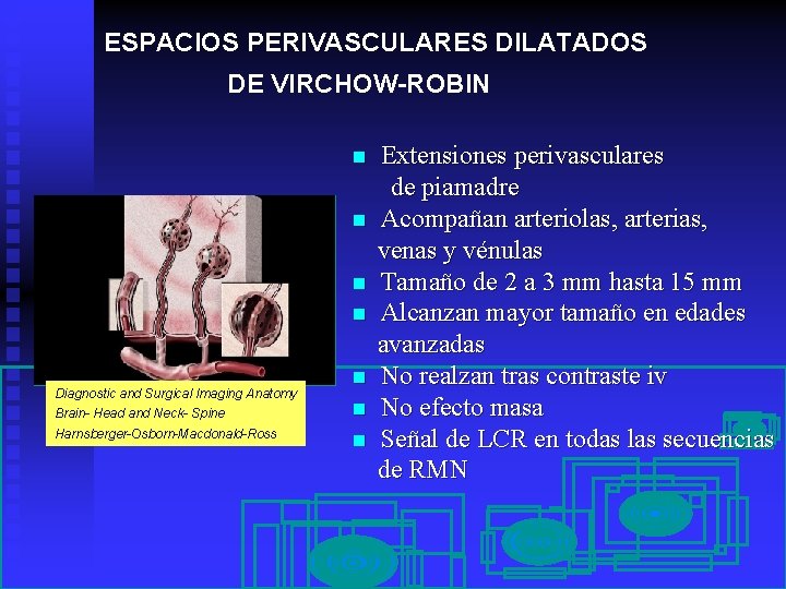 ESPACIOS PERIVASCULARES DILATADOS DE VIRCHOW-ROBIN n n Diagnostic and Surgical Imaging Anatomy n Brain-