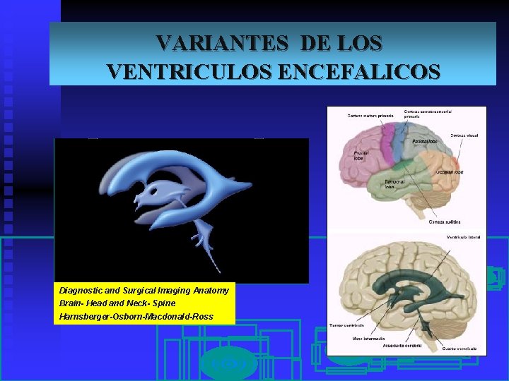 VARIANTES DE LOS VENTRICULOS ENCEFALICOS Diagnostic and Surgical Imaging Anatomy Brain- Head and Neck-