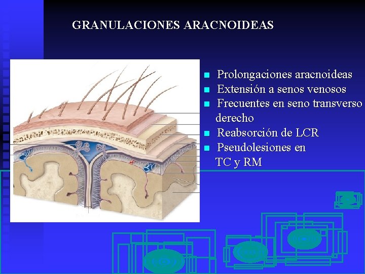 GRANULACIONES ARACNOIDEAS n n n Prolongaciones aracnoideas Extensión a senos venosos Frecuentes en seno